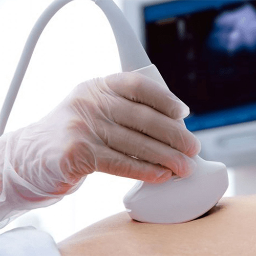 Ultrasonido de órganos – Fundación Victoria Vivanco